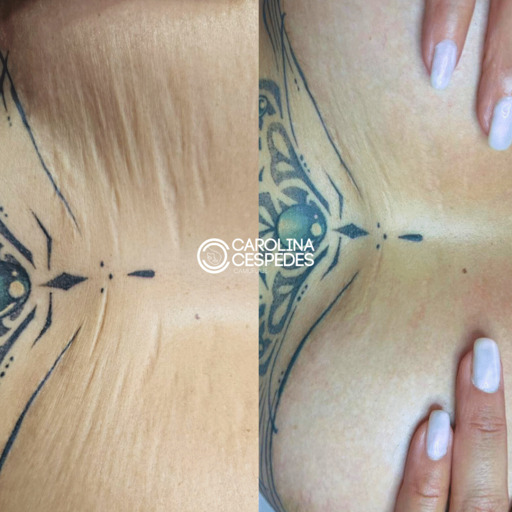 Antes y después Carolina Céspedes (1)