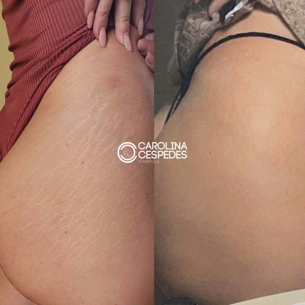 Antes y después Carolina Céspedes (11)