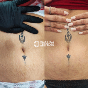 Antes y después Carolina Céspedes (13)