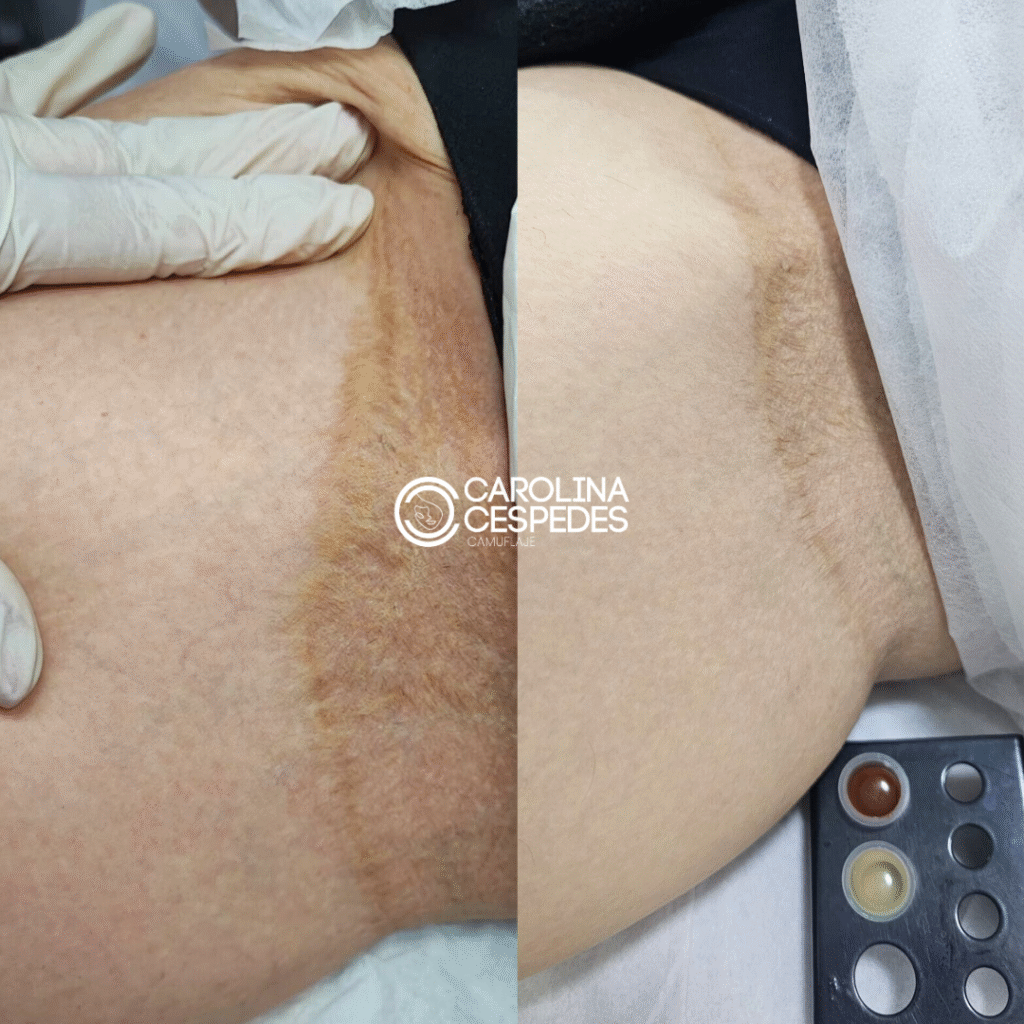 Antes y después Carolina Céspedes (14)