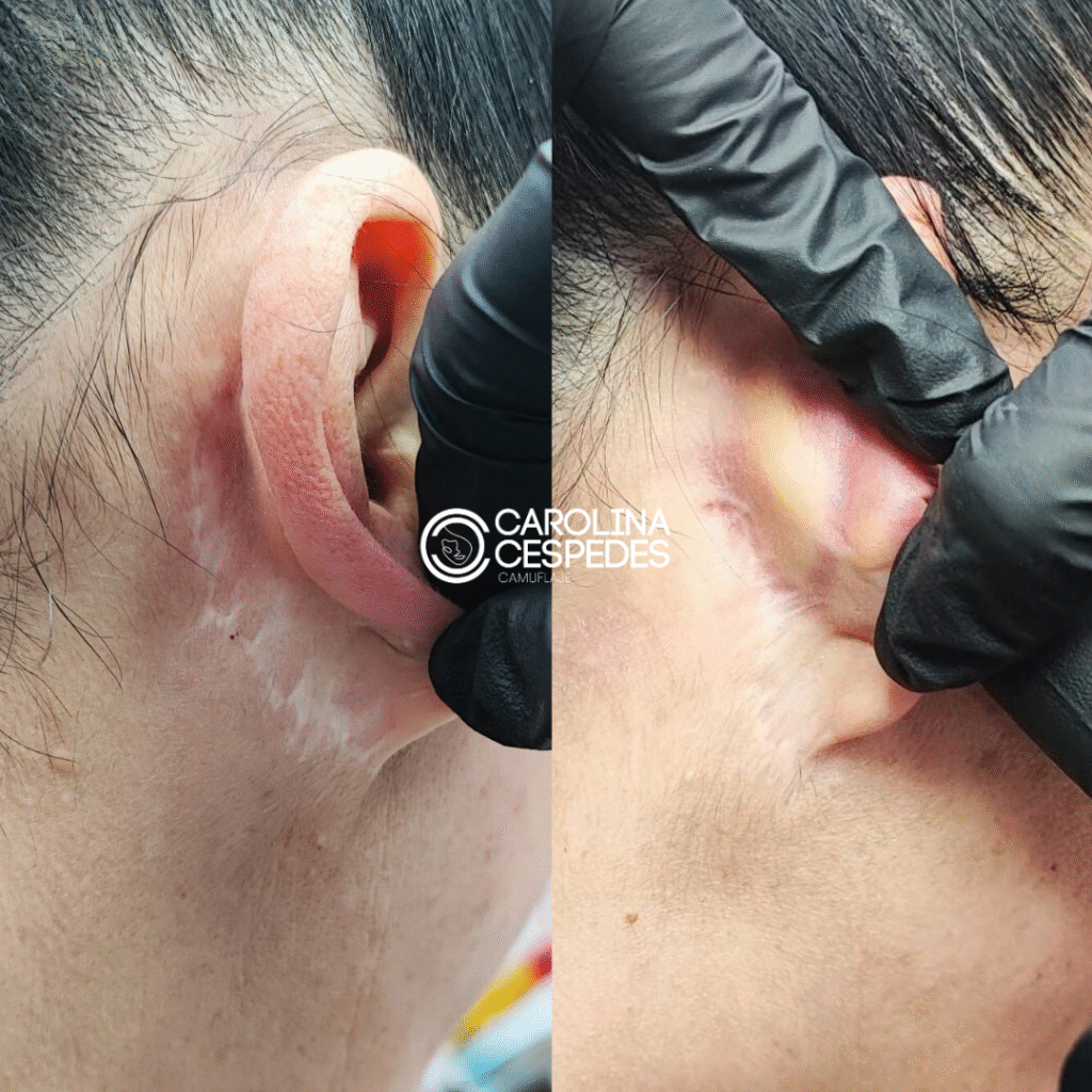 Antes y después Carolina Céspedes (15)