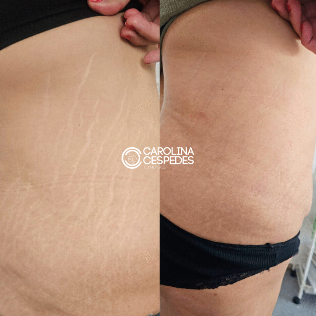 Antes y después Carolina Céspedes (17)