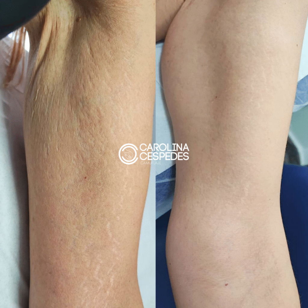 Antes y después Carolina Céspedes (2)