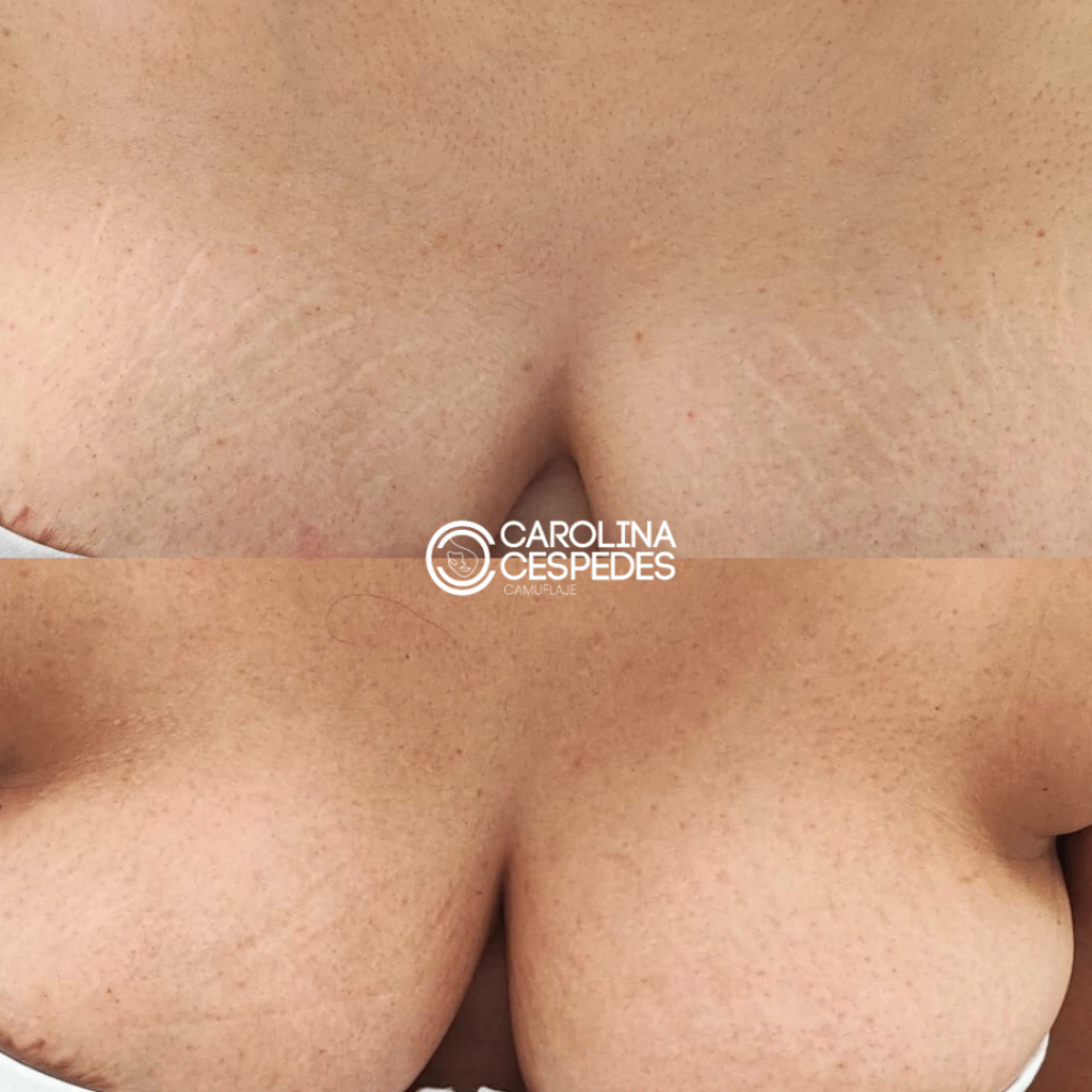 Antes y después Carolina Céspedes (21)