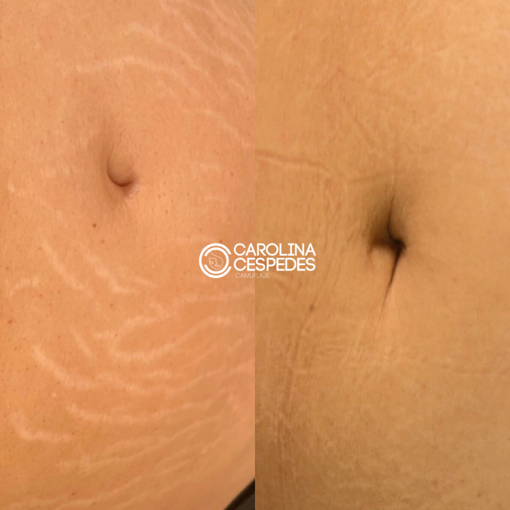 Antes y después Carolina Céspedes (4)