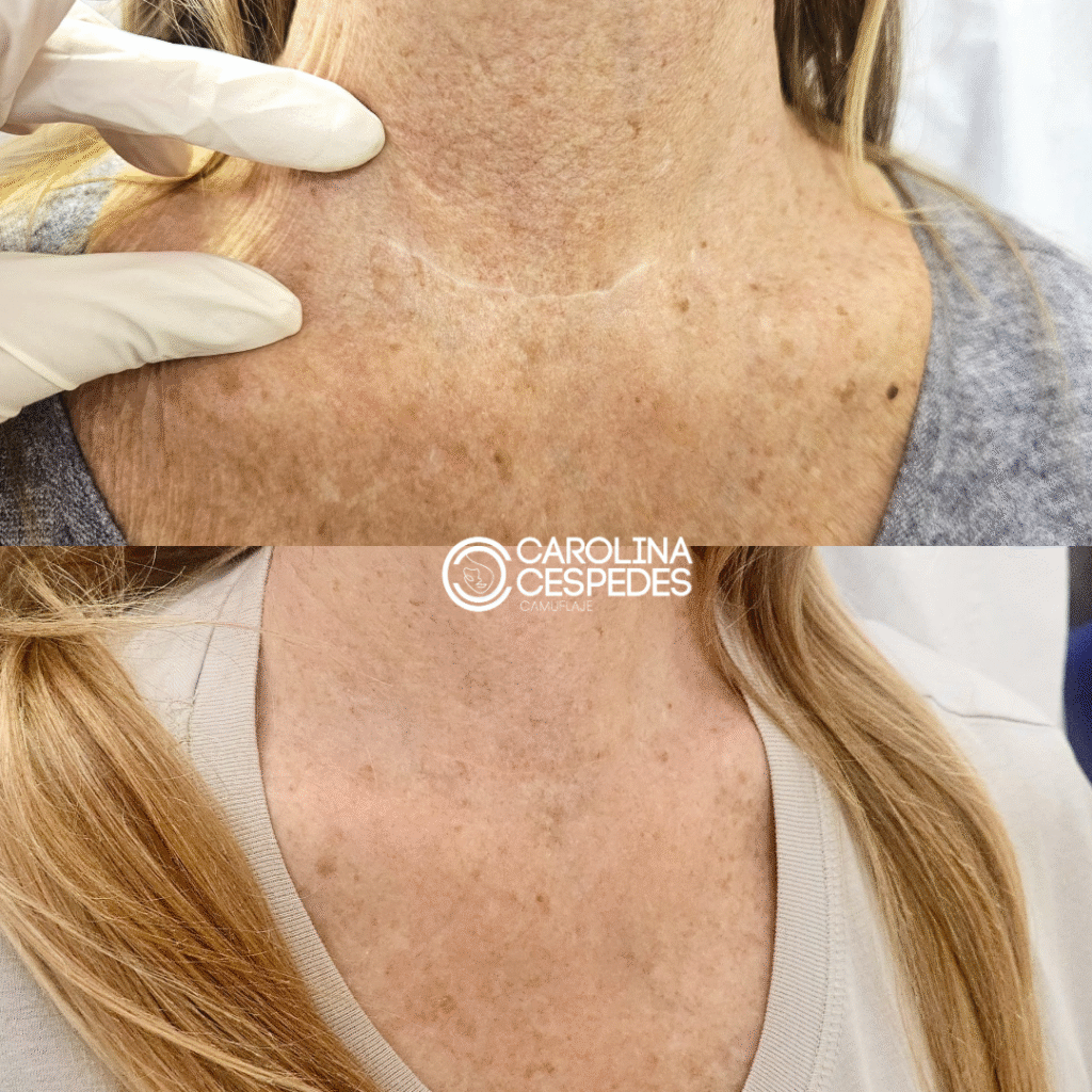 Antes y después Carolina Céspedes (7)