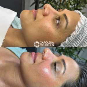 Antes y después Carolina Céspedes (9)